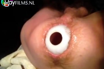 Een alziend oog als kontgaatje